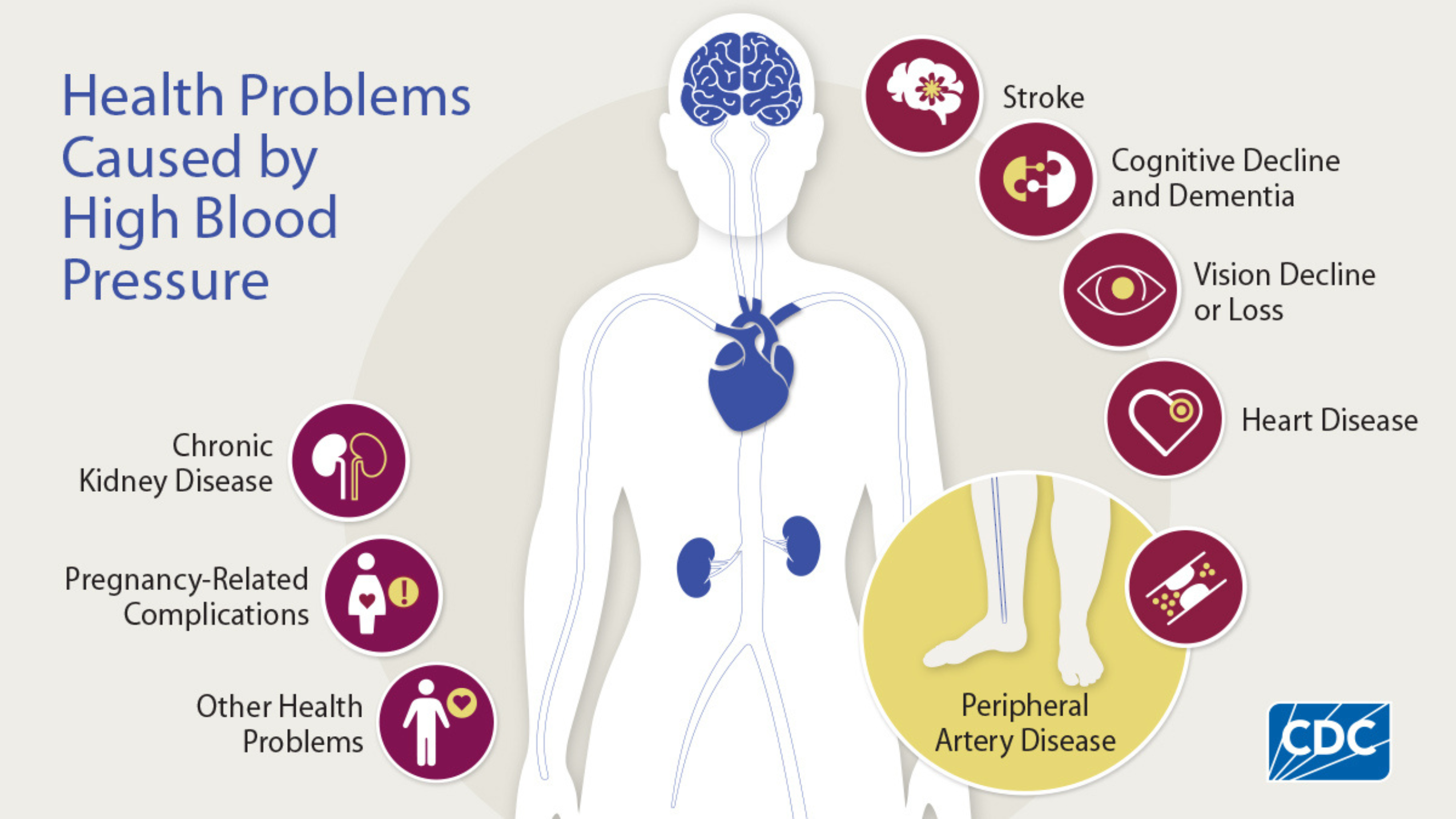An Illustration of Health Problems Caused by High Blood Pressure. A line drawing of the human body with the focus on the brain, heart and the kidneys. Surrounding the body are icons paired with the following text: Chronic Kidney Disease, Pregnancy-Related Complications, Other Health Problems, Stroke, Cognitive Decline and Dementia, Vision Decline or Loss, Heart Disease, and Peripheral Artery Disease. The CDC logo is in the lower right.